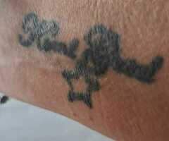 Tattoo en PMU weg laseren