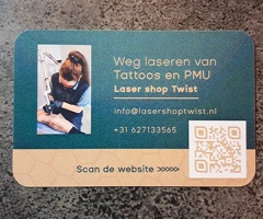 Tattoo, PMU en pigmentvlekken weg laseren